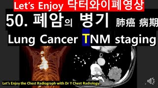 50폐암 병기 TNM 9th CT사진lung cancer 9th TNM staging CAT scan폐암TNM 9th 병기X선폐암진단폐암사진닥터와이폐영상 [upl. by Etteniuq]