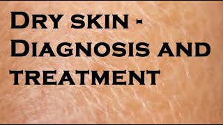 Dry skin  Diagnosis and treatment [upl. by Lillie]