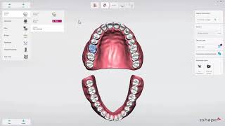 Introduction to 3Shape TRIOS on Dental Desktop [upl. by Fromma]