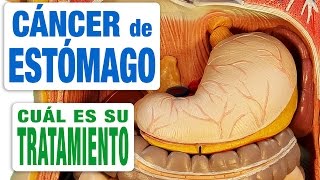 Cáncer de Estómago  Tratamiento [upl. by Laurence860]