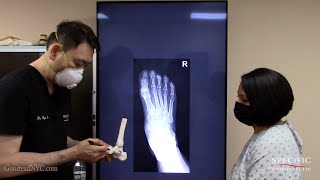 RSD CRPS in Foot HELPED by Dr Suh Gonstead Chiropractic NYC Manhattan Midtown [upl. by Whit]