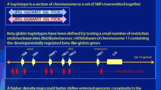 Betaglobino haplotype analysis in children with sickle cell anemia [upl. by Montanez]