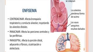 EPOC medicina interna de harrison ed 18 [upl. by Ludeman]