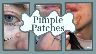 A Pimple Patch Tiktok Compilation [upl. by Vitoria]