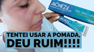 RESENHA ACNEZIL GEL  POMADA CONTRA CRAVOS E ESPINHAS  TESTEI COMO FOI [upl. by Karyl]