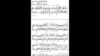 Liszt Widmung 연습 안하면 이렇게 된다 연습 많이해도 이렇게 된다 [upl. by Thibaut]