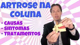 Artrose na coluna o que é quais sintomas e como tratar artrose na coluna lombar e cervical [upl. by Higginbotham]