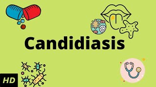 CANDIDIASIS Causes Signs and Symptoms Diagnosis and Treatment [upl. by Tzong110]