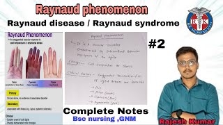 Raynaud phenomenon raynaud diseasesyndromeINTEGUMENTARYPROBLEMS BSCNURSING AND GNMrknursingpoint [upl. by Weider380]