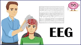 EEG Electroencephalogram  How It Is Done Indications Types Of EEG  Patient Education [upl. by Bolen]