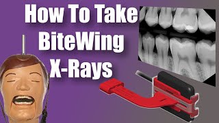 Bitewings X Rays  Dental Tips and Tricks [upl. by Hsot]