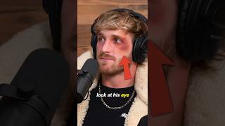 🤕 LOGAN PAUL GOT ATTACKED [upl. by Ahsiya454]