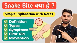 Snake Bite in Hindi  Types Symptoms Prevention And Treatment of Snake Bite [upl. by Francesco81]