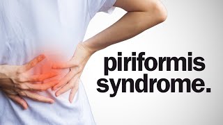 Everything You Need To Know About Piriformis Syndrome [upl. by Riccio]