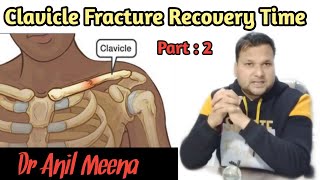 Clavicle bone fracture recovery time  clavicle bone Fracture treatment  collar bone  in hindi [upl. by Debbie]