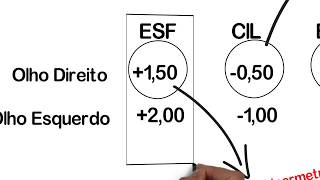 Entenda sua Receita Oftalmológica [upl. by Edroi]