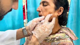 Examination of Parotid Lump [upl. by Akirat]