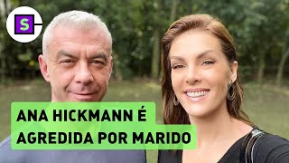 Ana Hickmann faz BO contra marido por agressão em briga apresentadora recusou medida protetiva [upl. by Weihs280]