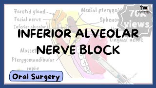 Inferior Alveolar Nerve Block Technique [upl. by Merrielle]