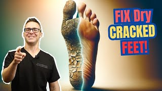 STOP Dry Itchy Skin amp Dry Cracked Feet Best Creams amp Home Remedies [upl. by Kalvin]