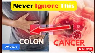 Most colon cancer symptoms you should never ignore [upl. by Branch]