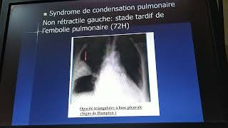 Sémiologie cardiaque et respiratoire  révision 1 cas cliniques examen [upl. by Sosthenna]