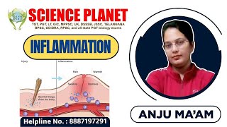 INFLAMATION II BY ANJU MAM II SCIENCE PLANET II [upl. by Joane]