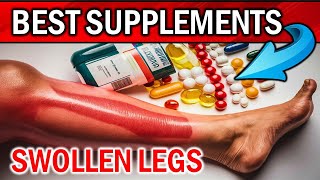 Best Vitamins Minerals amp Supplements To Stop Swelling in Feet and Legs [upl. by Gal986]