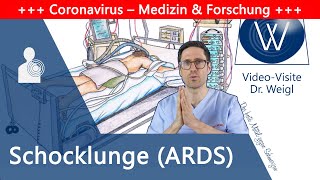 ARDS Akutes Lungenversagen durch Coronavirus amp Influenza – Schocklunge als gefährliche Komplikation [upl. by Monti]