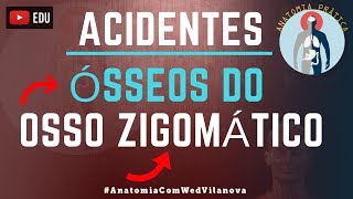 Osso Zigomático ACIDENTES ÓSSEOS Quais são❗❓DESCUBRA AQUI❗ Anatomia Prática [upl. by Aenit]