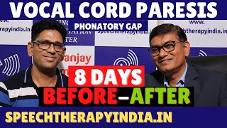 BeforeAfter Therapy  Vocal Cord Paresis With Phonatory Gap  8 Days Treatment  slpsanjaykumar [upl. by Llamaj]