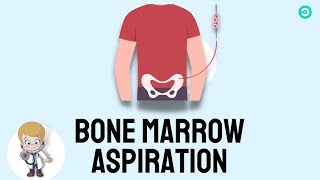 Bone marrow Aspiration and Biopsy Procedure explained [upl. by Aneger]