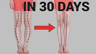 Get Straight Legs in 30 Days Fix O or XShaped Legs Knee Internal Rotation [upl. by Stimson553]