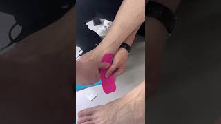 Using kinesiology tape can help prevent heel injuries and relieve heel pain [upl. by Hait]