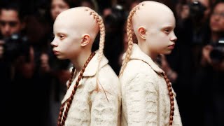 Meet The Rarest Black Twins In The World [upl. by Dichy869]