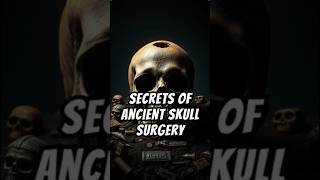 Trepanation Unearthing the Secrets of Ancient Skull Surgery shorts trepanation [upl. by Jaquiss]