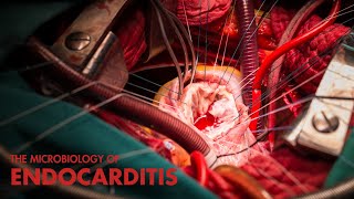 Microbiology of Endocarditis Study Tips amp Hacks [upl. by Ridinger]