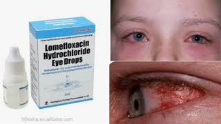 Levofloxacin hcl eye drop antibiotic eye drop uses  side effect  treatment optometry solution [upl. by Malan]