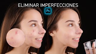 Eliminar IMPERFECCIONES de la CARA Photoshop 🔵 Quitar Manchas PIEL [upl. by Dolly213]