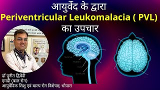 Periventricular Leukomalacia  Causes Symptoms and Treatment in Ayurveda  डॉ पुनीत द्विवेदी [upl. by Xer]