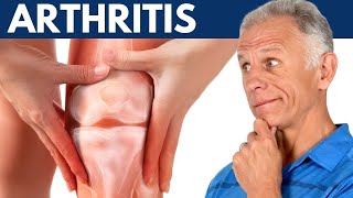 What I Wish Everyone Would Know About Arthritis [upl. by Sardse261]