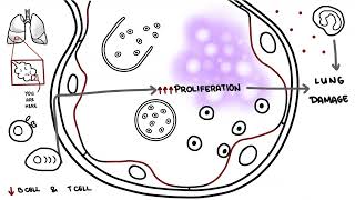 Pneumocystis jirovecii  Pneumocystis pneumonia [upl. by Coit]