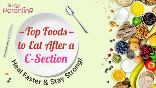 Diet After CSection Delivery  Foods To Eat After CSection [upl. by Elohcan738]