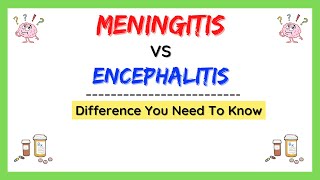 Meningitis and encephalitis difference causes symptoms treatment pathology made easy [upl. by Eihtak]