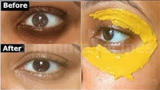 i used Turmeric Eye Mask amp Got Rid of DARK CIRCLES in 7 Days Remove Eye Wrinkles amp Under Eye Bags [upl. by Kolosick]