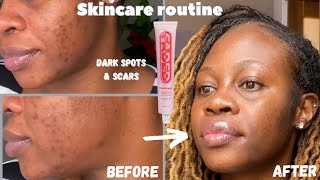 Get rid of dark spots with one product Faded by Topicals review [upl. by Lanti]