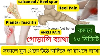 Exercise for Heel Pain  Calcaneal Spur  Heel Spur  Plantar Fasciitis By Physio Dr Joy [upl. by Rennug]