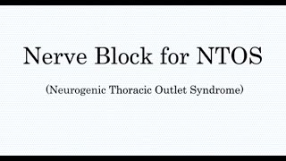 Nerve Block Treatment for Thoracic Outlet Syndrome TOS [upl. by Dilahk]