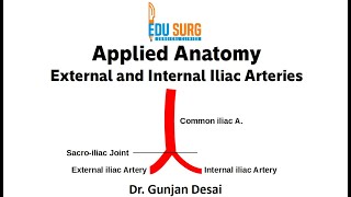 Anatomy essentials  Internal iliac artery branches External iliac artery May Thurner Syndrome [upl. by Leamaj309]