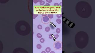 Is reticulocyte the same as polychromatophilic RBC shorts medtech medtechstudent foryou fyp [upl. by Eidlog]